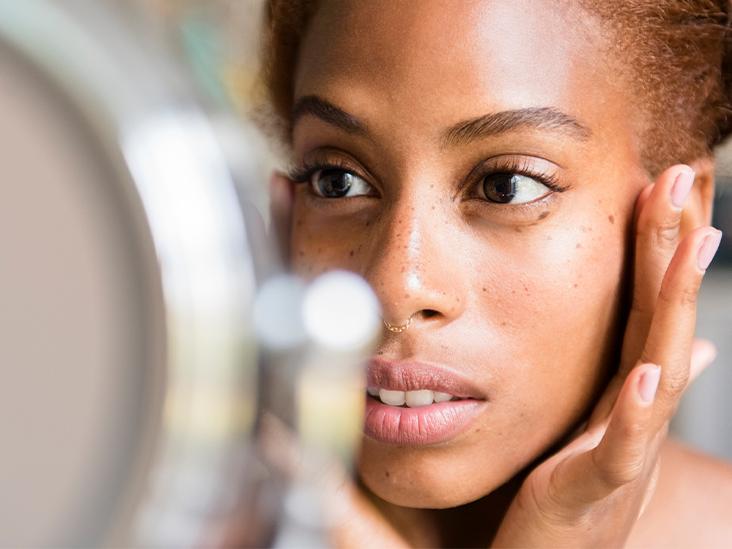 Eczema Looks Different on Melanated Skin; Here's How to Treat It