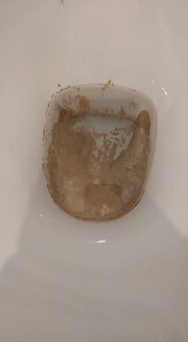 Woman shares clever tip for removing limescale from toilet 