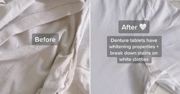 Woman Shares Surprising Method for Removing Stains From White Clothing