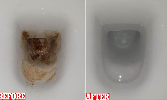 Mother uses $11 cleaning product to remove stubborn stains in the toilet