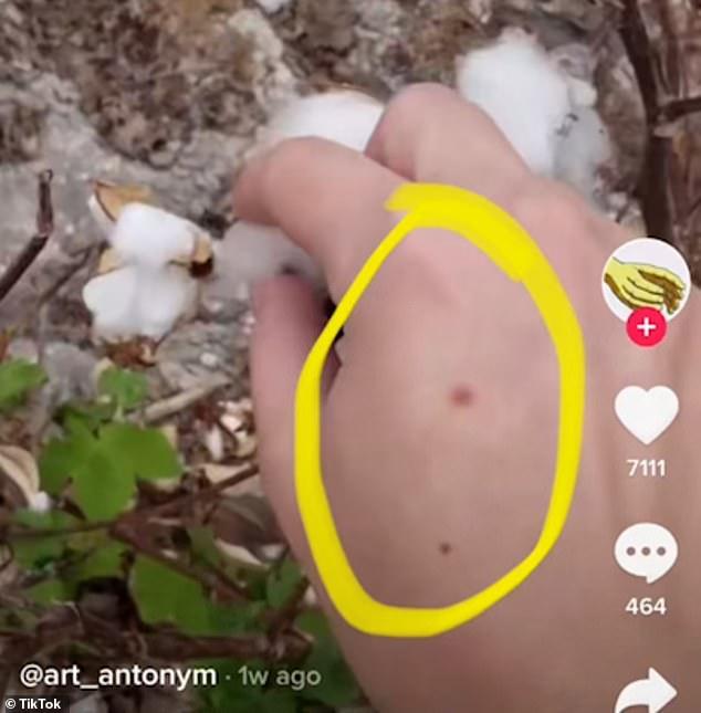 Artist banned from Society6 after TikToker uses moles to identify her in racist cotton-picking video 