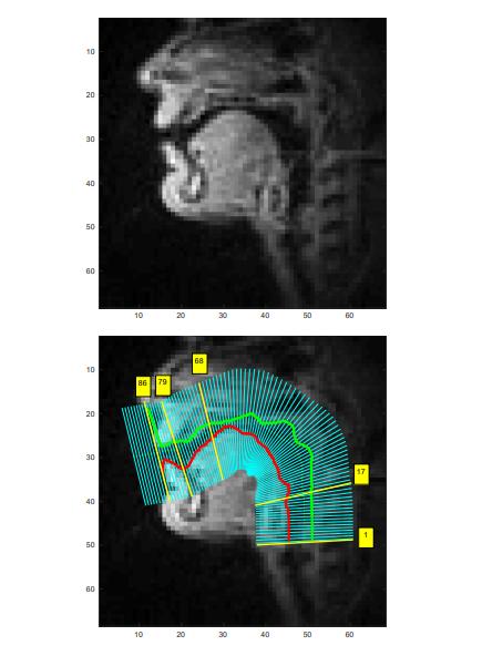  のどの動きをMRIで解析し、口パクをテキストに変換　言語障がい者などのコンピュータ利用の一助に