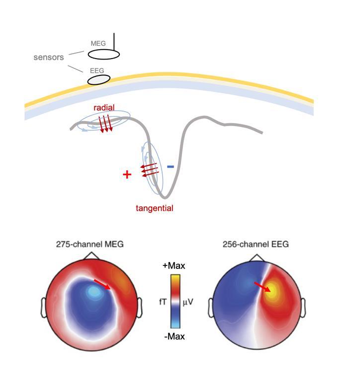 Brain structural and functional correlates to defense-related inhibition of muscle sympathetic nerve activity in man 