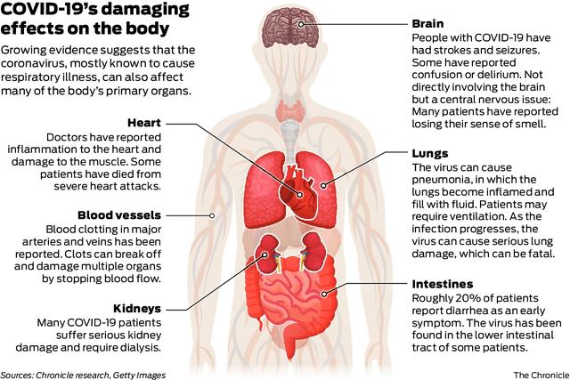 Impact of COVID-19 virus on the Heart & blood flow | IDR 