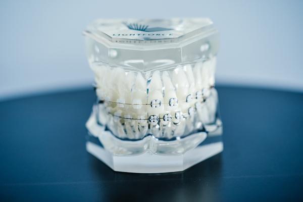 LightForce Orthodontics raises $50 million Series C funding to advance custom 3D printed braces