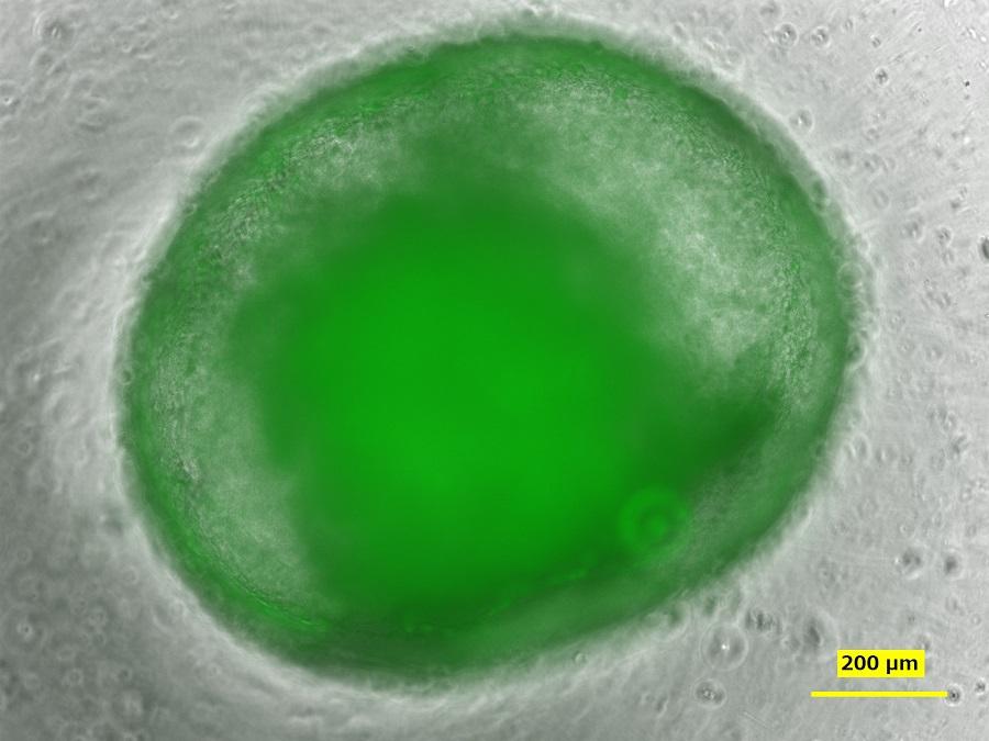 ヒトiPS細胞から創生した「ミニ腸」で三大栄養（糖質・タンパク質・脂質）の吸収を確認 