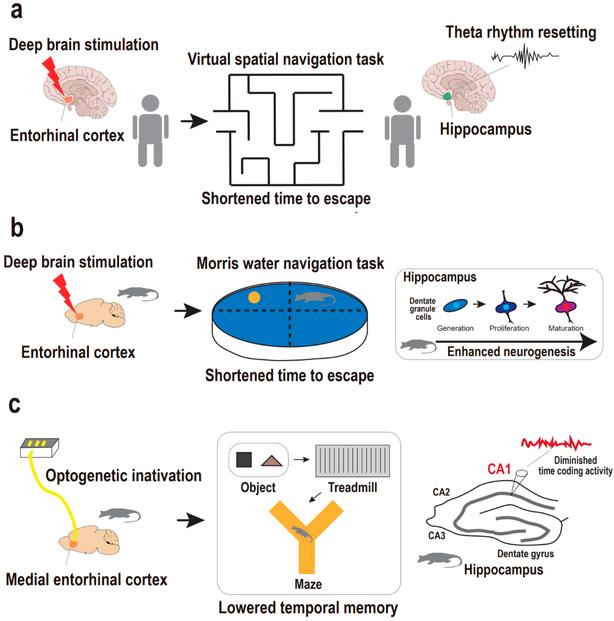 Disrupted connectivity in the olfactory bulb-entorhinal cortex-dorsal hippocampus circuit is associated with recognition memory deficit in Alzheimer’s disease model 