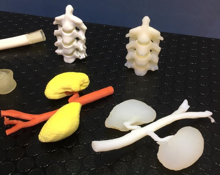 AMS Speaker Spotlight: Democratizing Patient-specific 3D Printed Anatomic Models