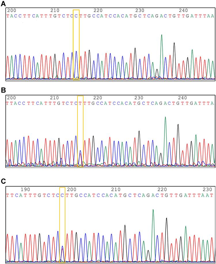 UGT2B7-161 PSL predict cardiotoxicity by PSL | PGPM 