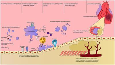 Obstructive sleep apnea and nocturnal hypoxemia | NSS 