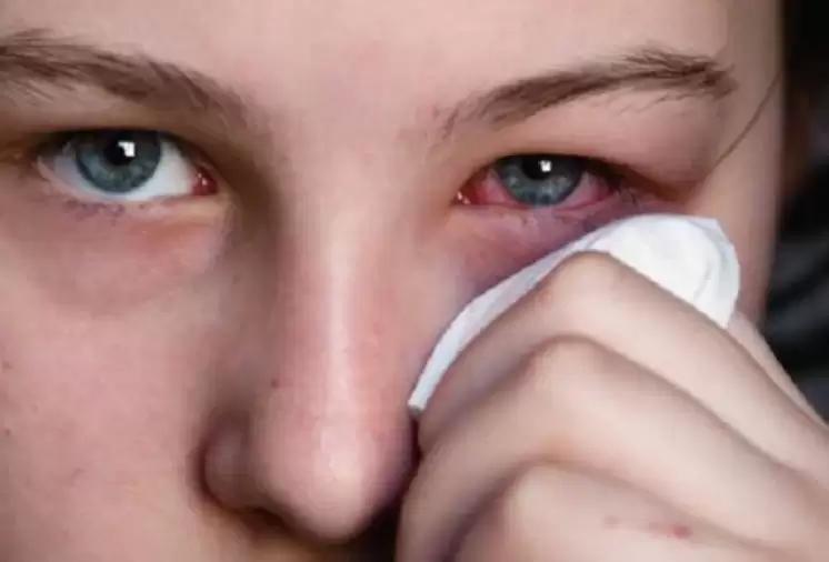Mind The Heat! Here's How Using Heaters Can Harm Your Eyes