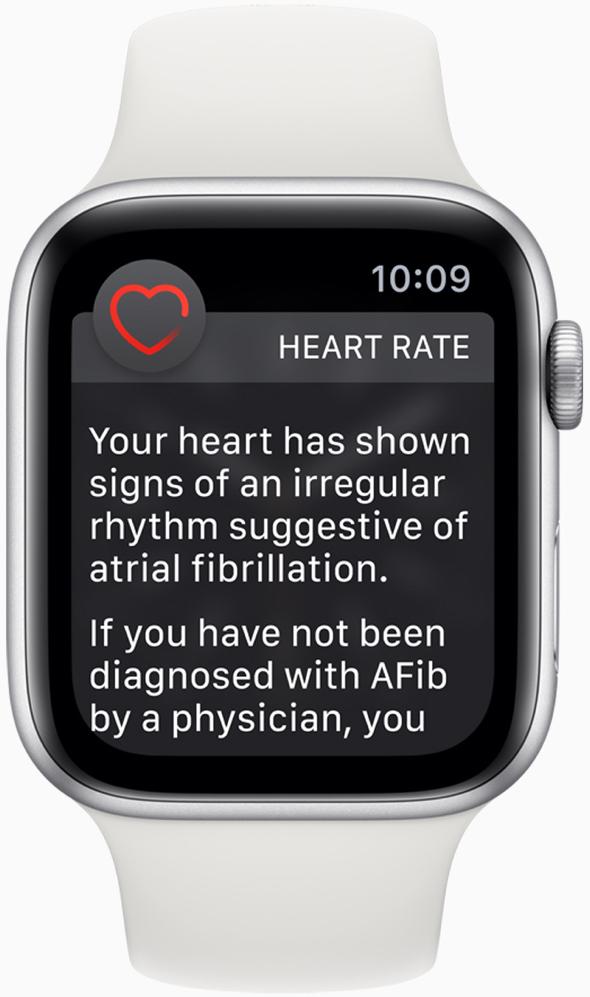 AFib alert on the Apple Watch proves to be a life saver 