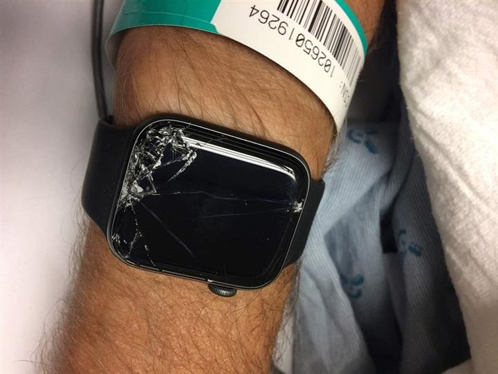 Apple smart watch saves an elderly man from death .. exciting details