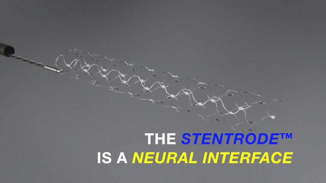 FDA Permits Clinical Trials For Vascular Stent-type Brain Computer ...