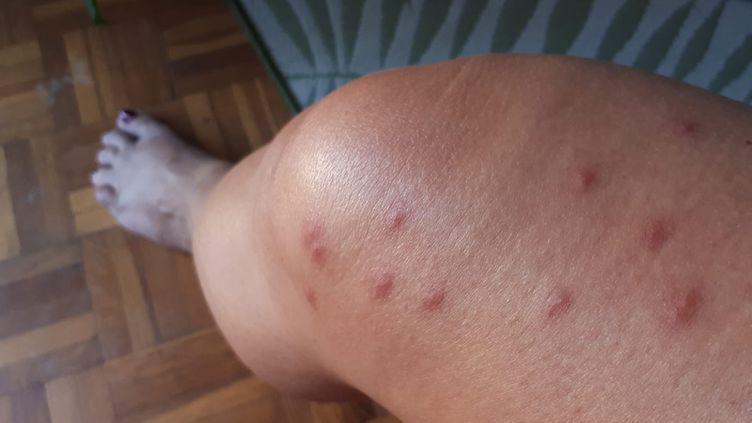 Why are there still so many mosquitoes in this season and how to get rid of it?