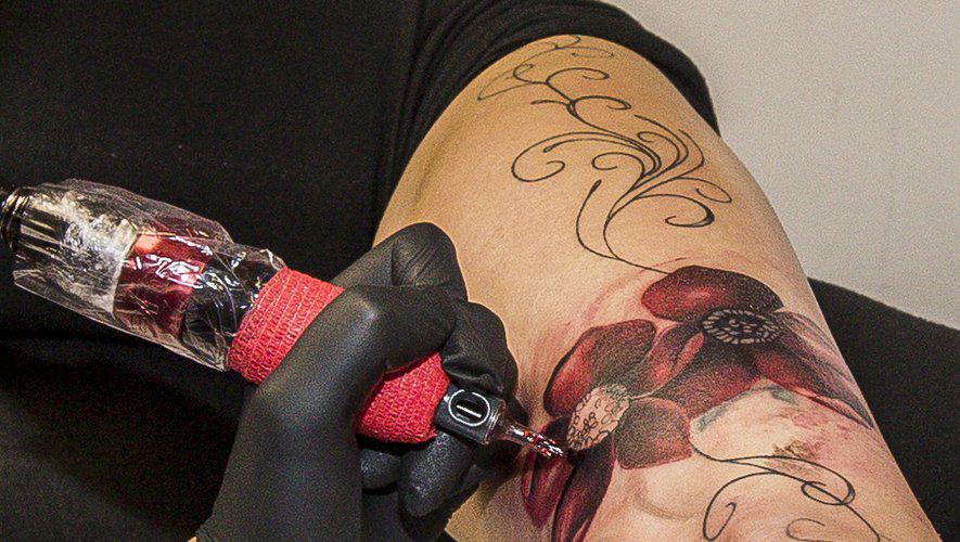 Comment effacer un tatouage raté ou qu'on n'assume plus