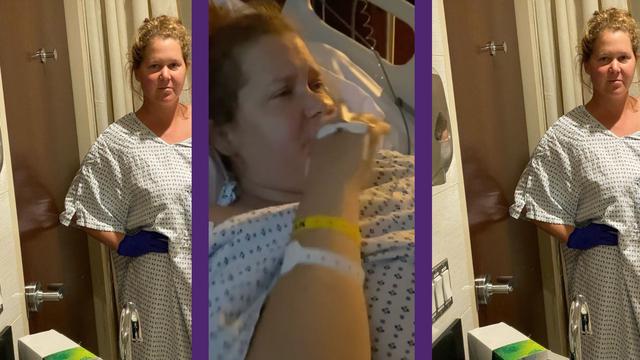 Suffering from endometriosis, comedian Amy Schumer has her uterus and appendix removed