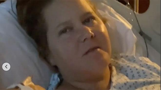 Endometriosis, the comedian Amy Schumer has her uterus and appendix removed 