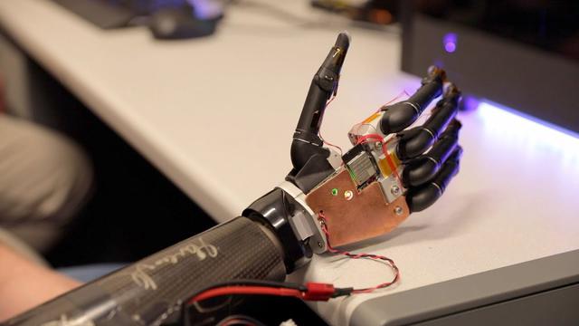 University of Minnesota technology allows amputees to control a robotic arm with their mind 