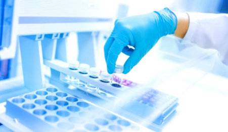 When Should You Add an Internal Standard? When Should You Add an Internal Standard?