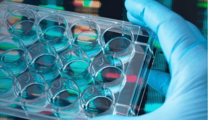 What Should You Expect From In Vitro ADME Services? What Should You Expect From In Vitro ADME Services?